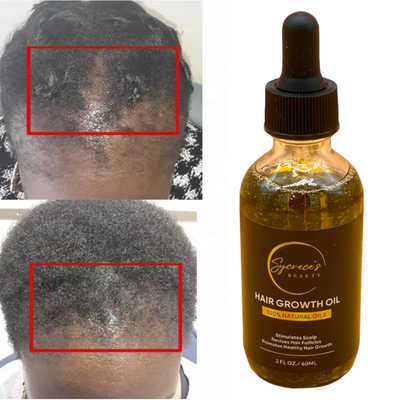 Nourishing Scalp Hair Growth Oil