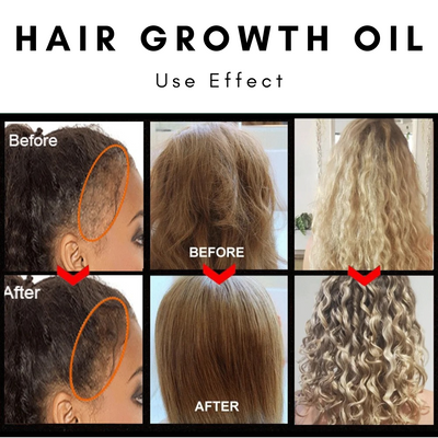 Nourishing Scalp Hair Growth Oil