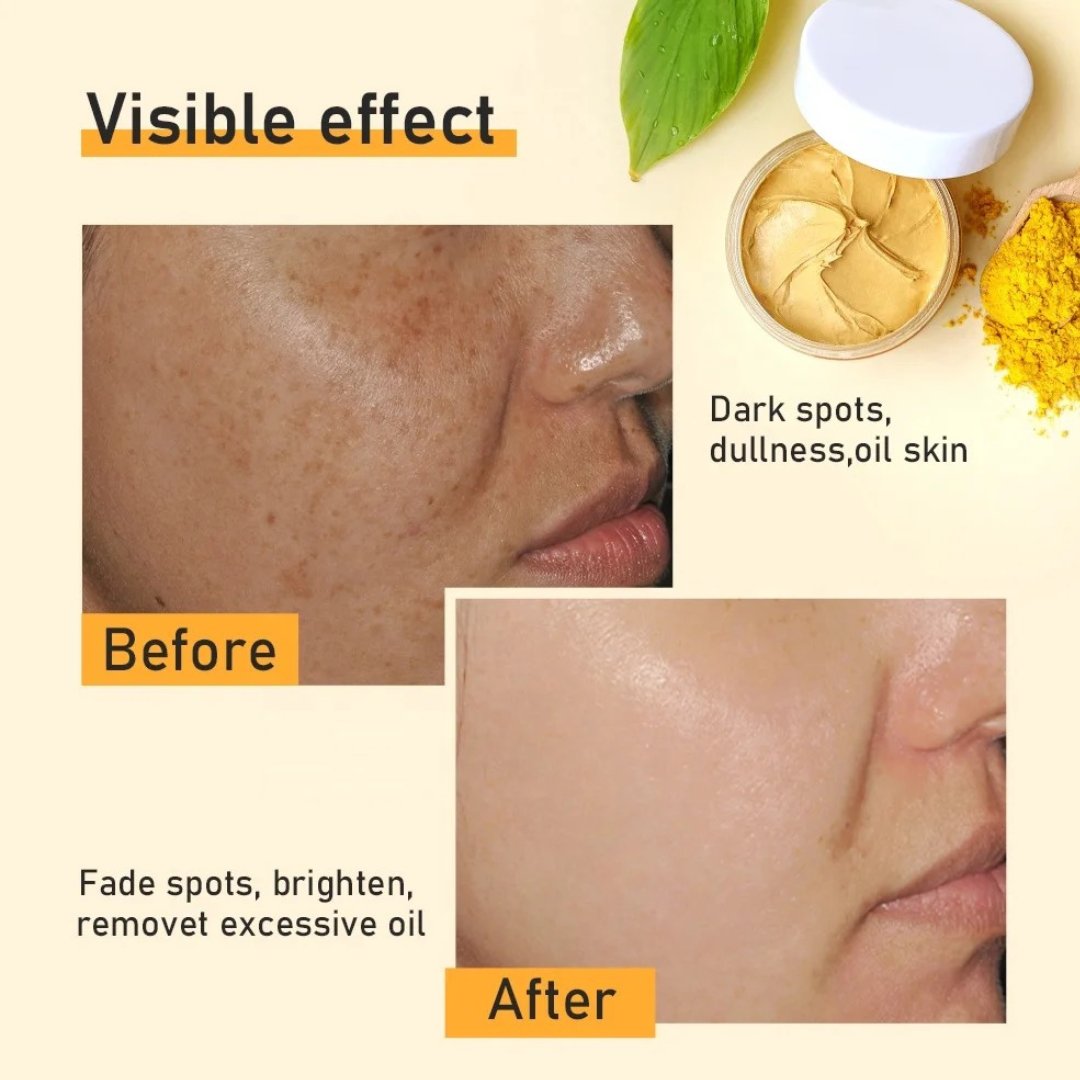 Turmeric Vitamin C & Aloe Vera Dark Spot Brightening Clay Mask